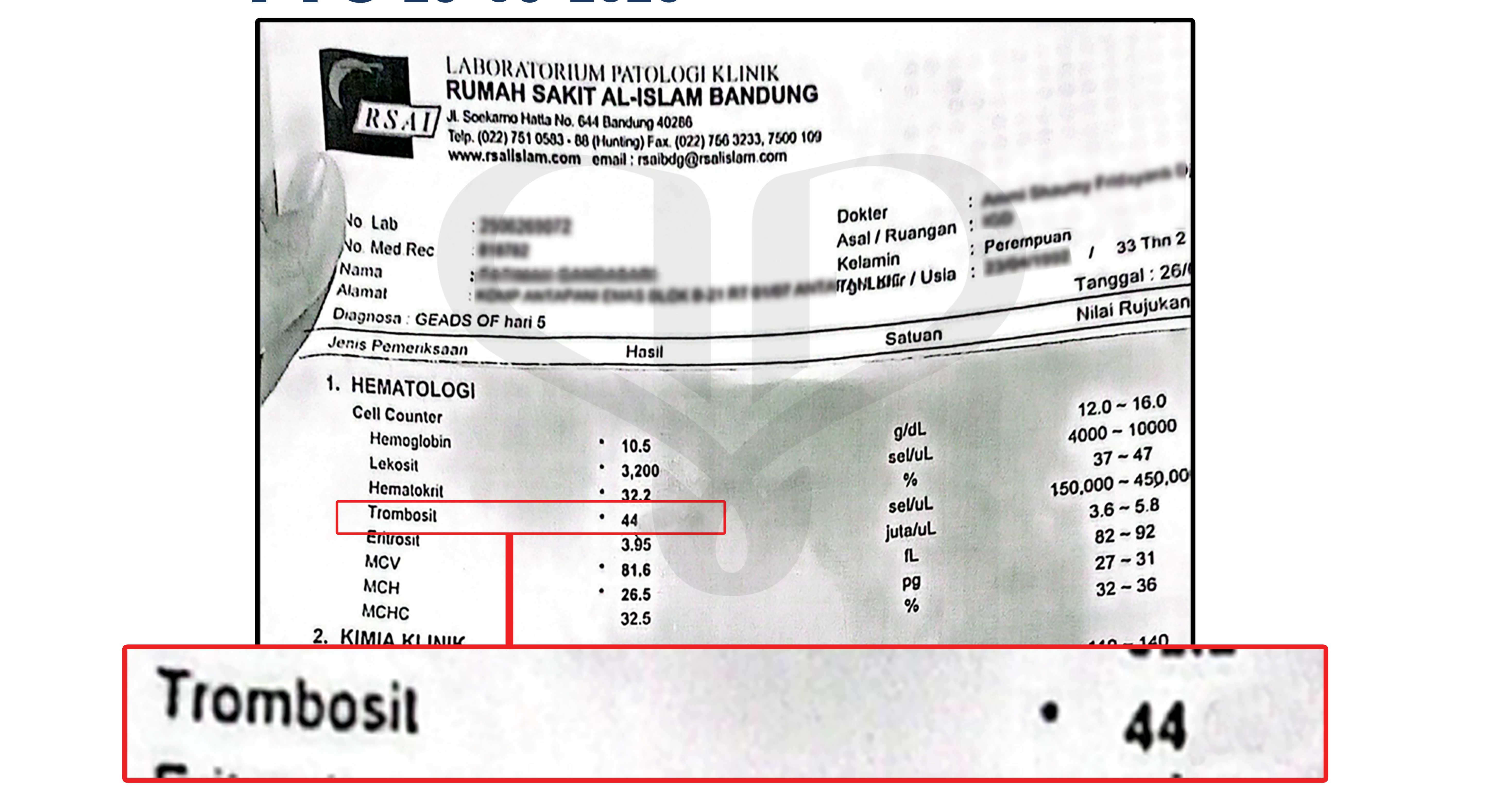 Hasil laboratorium awal pasien ITP pada 26 Juni 2025